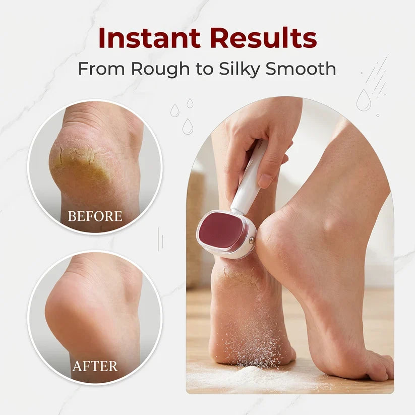 ✨📢LAST DAY SALE🔥BUY 1 GET 1 FREE🔥Double-Sided Foot Scraper for Callus Removal