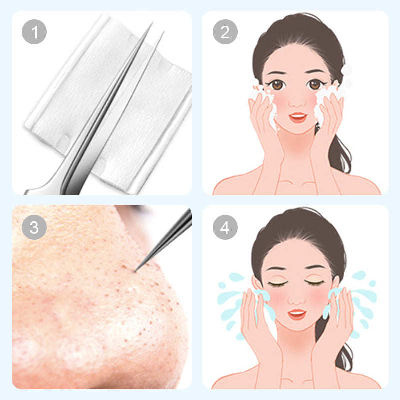 🔥Limit Time 50% OFF🔥Stainless Steel Blackhead Remover Tool Kit