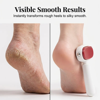 📢Buy one get one free for a limited time✨Double Sided Foot Scraper For Removing Calluses And Dead Skin
